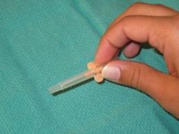 Removing the protection cap from the Insuflon. During insertion, hold the Insuflon hub between the thumb and index finger.